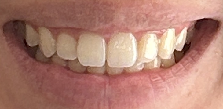 After